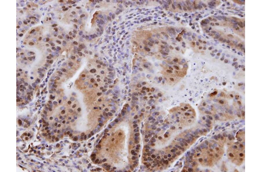 Immunohistochemistry - EPS8 antibody from Signalway Antibody (22105) - Antibodies.com
