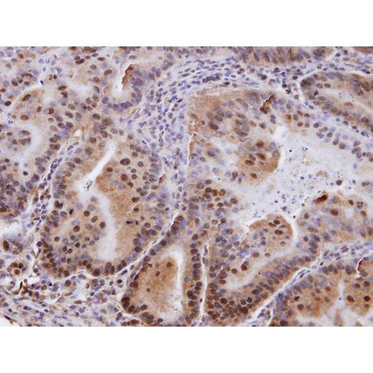Immunohistochemistry - EPS8 antibody from Signalway Antibody (22105) - Antibodies.com