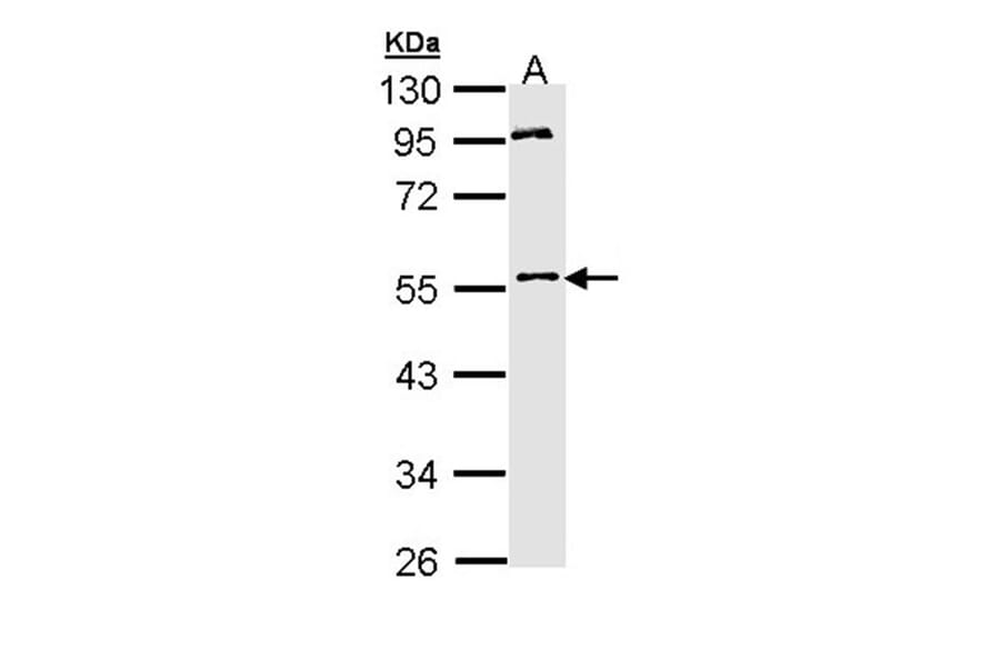 MPP1 antibody from Signalway Antibody (22187) - Antibodies.com