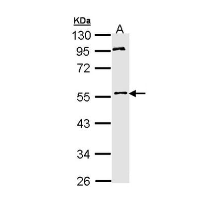 MPP1 antibody from Signalway Antibody (22187) - Antibodies.com