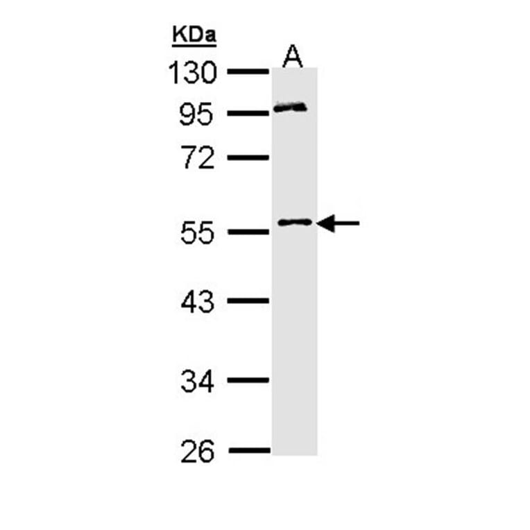 MPP1 antibody from Signalway Antibody (22187) - Antibodies.com