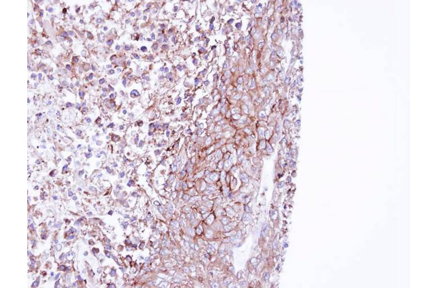 Immunohistochemistry - MPP1 antibody from Signalway Antibody (22187) - Antibodies.com