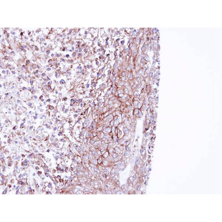 Immunohistochemistry - MPP1 antibody from Signalway Antibody (22187) - Antibodies.com