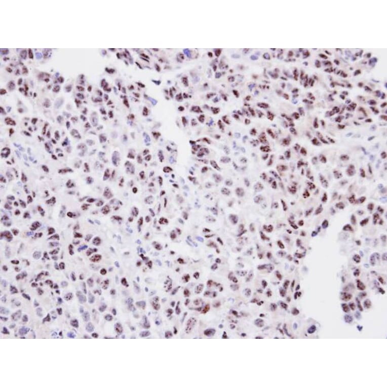 Immunohistochemistry - ORC2 antibody from Signalway Antibody (22192) - Antibodies.com