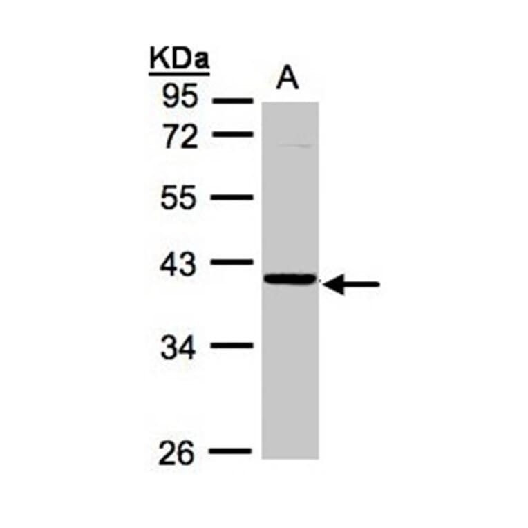 ASB4 antibody from Signalway Antibody (22205) - Antibodies.com