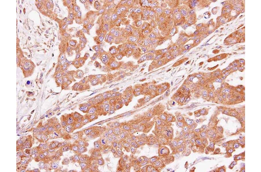 Immunohistochemistry - ASB4 antibody from Signalway Antibody (22205) - Antibodies.com