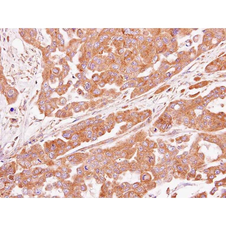 Immunohistochemistry - ASB4 antibody from Signalway Antibody (22205) - Antibodies.com