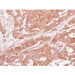 Immunohistochemistry - ASB4 antibody from Signalway Antibody (22205) - Antibodies.com