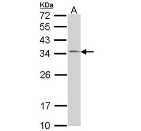 HUS1 antibody from Signalway Antibody (22217) - Antibodies.com