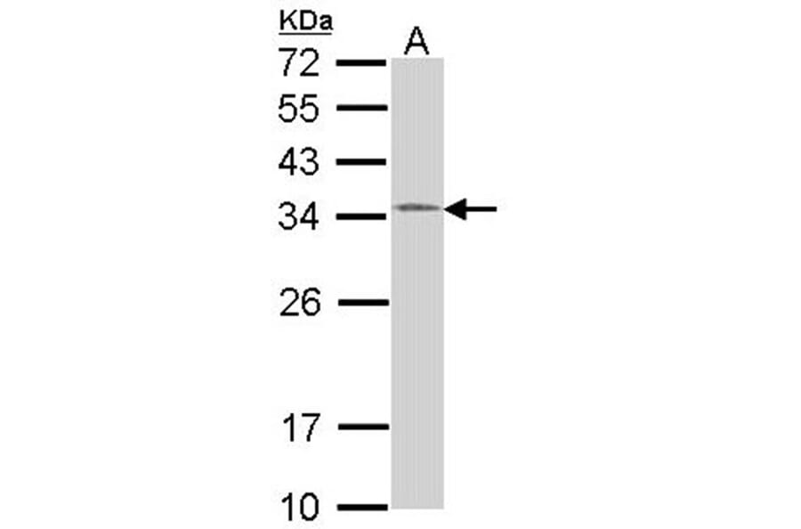 HUS1 antibody from Signalway Antibody (22217) - Antibodies.com