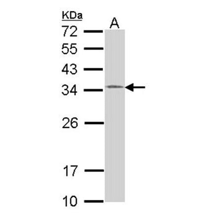 HUS1 antibody from Signalway Antibody (22217) - Antibodies.com