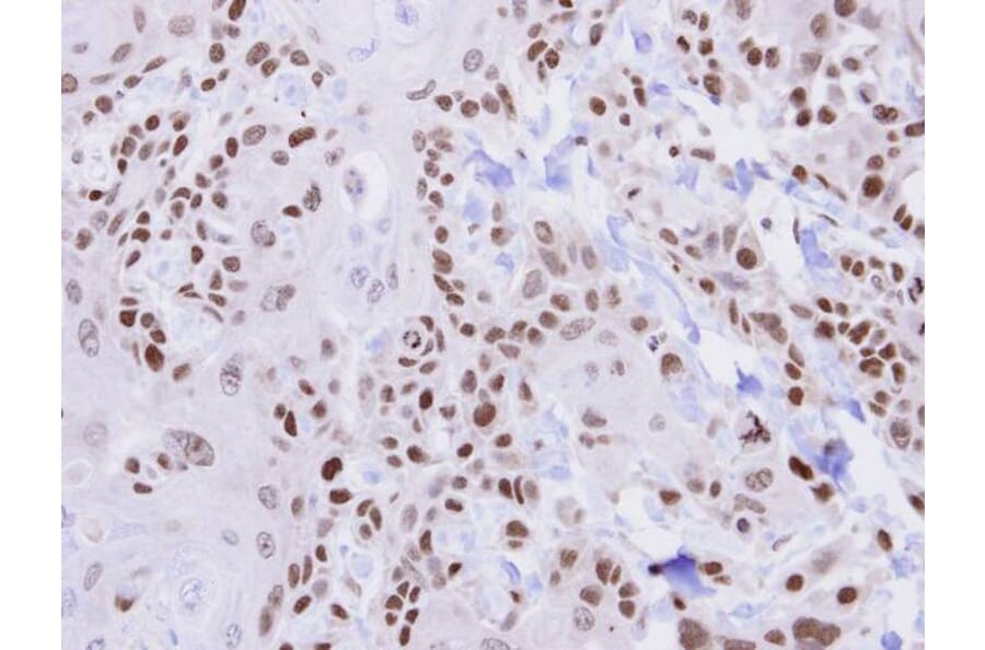 Immunohistochemistry - HUS1 antibody from Signalway Antibody (22217) - Antibodies.com