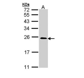 TC21 antibody from Signalway Antibody (22241) - Antibodies.com