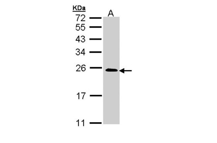 TC21 antibody from Signalway Antibody (22241) - Antibodies.com