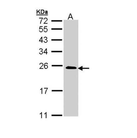 TC21 antibody from Signalway Antibody (22241) - Antibodies.com