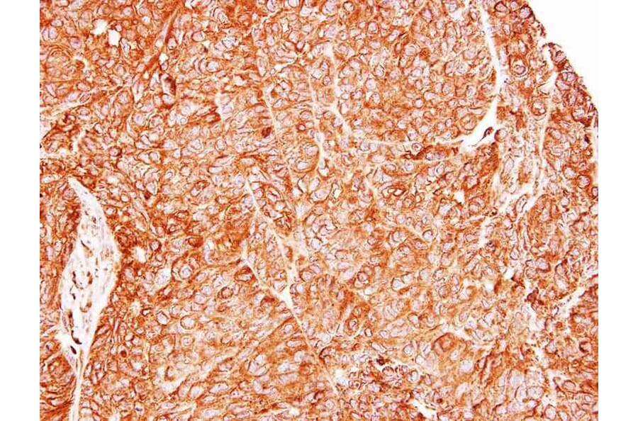 Immunohistochemistry - TC21 antibody from Signalway Antibody (22241) - Antibodies.com
