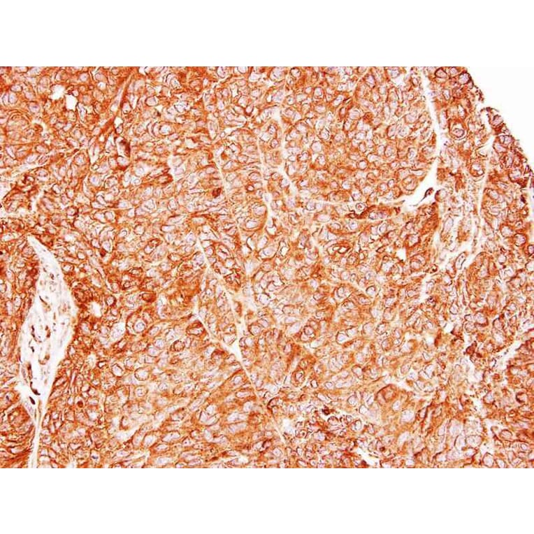 Immunohistochemistry - TC21 antibody from Signalway Antibody (22241) - Antibodies.com
