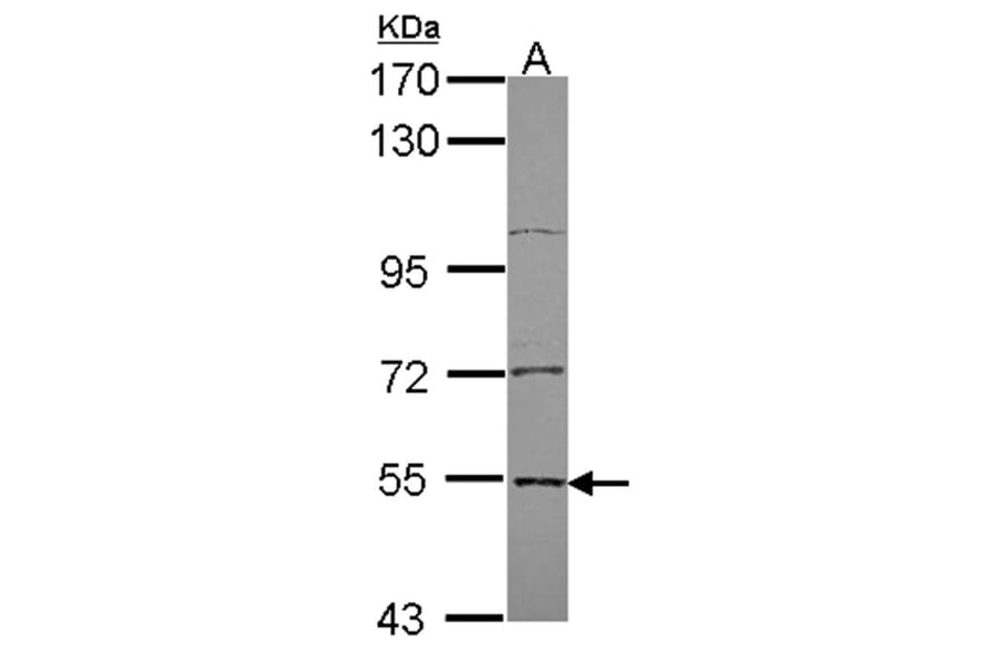 Edc3 antibody from Signalway Antibody (22272) - Antibodies.com