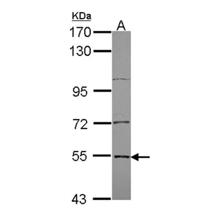Edc3 antibody from Signalway Antibody (22272) - Antibodies.com