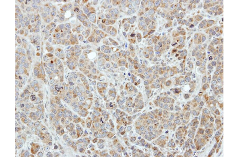 Immunohistochemistry - Edc3 antibody from Signalway Antibody (22272) - Antibodies.com