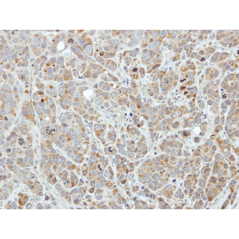 Immunohistochemistry - Edc3 antibody from Signalway Antibody (22272) - Antibodies.com