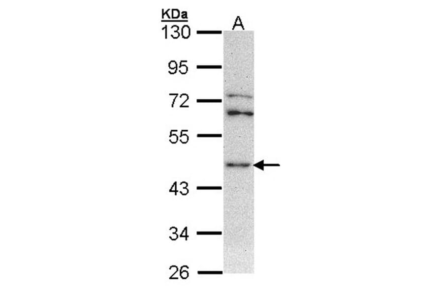 ASS1 antibody from Signalway Antibody (22288) - Antibodies.com