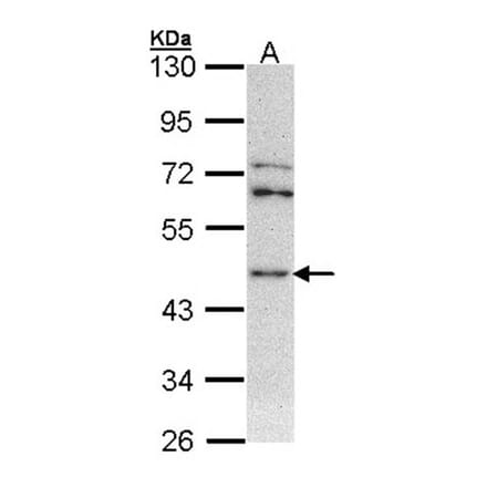ASS1 antibody from Signalway Antibody (22288) - Antibodies.com