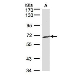 GGT1 antibody from Signalway Antibody (22307) - Antibodies.com
