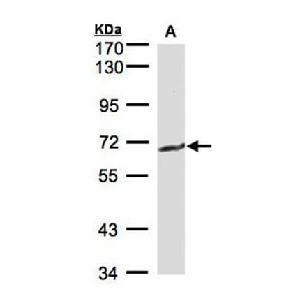 GGT1 antibody from Signalway Antibody (22307) - Antibodies.com