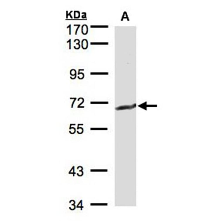 GGT1 antibody from Signalway Antibody (22307) - Antibodies.com