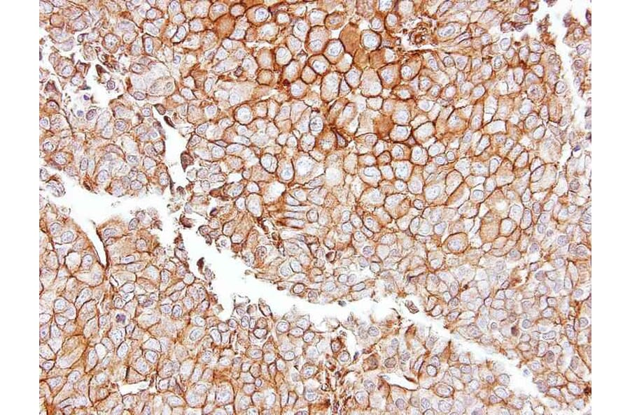 Immunohistochemistry - GGT1 antibody from Signalway Antibody (22307) - Antibodies.com