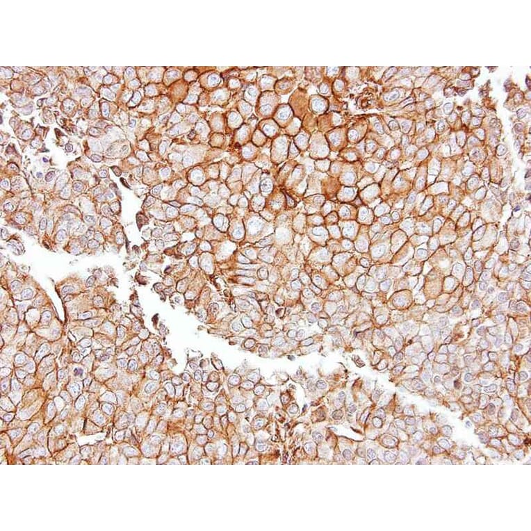 Immunohistochemistry - GGT1 antibody from Signalway Antibody (22307) - Antibodies.com
