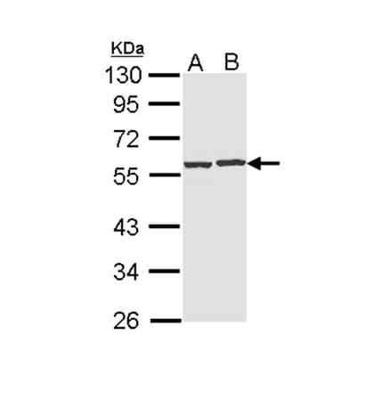 CAP1 antibody from Signalway Antibody (22330) - Antibodies.com
