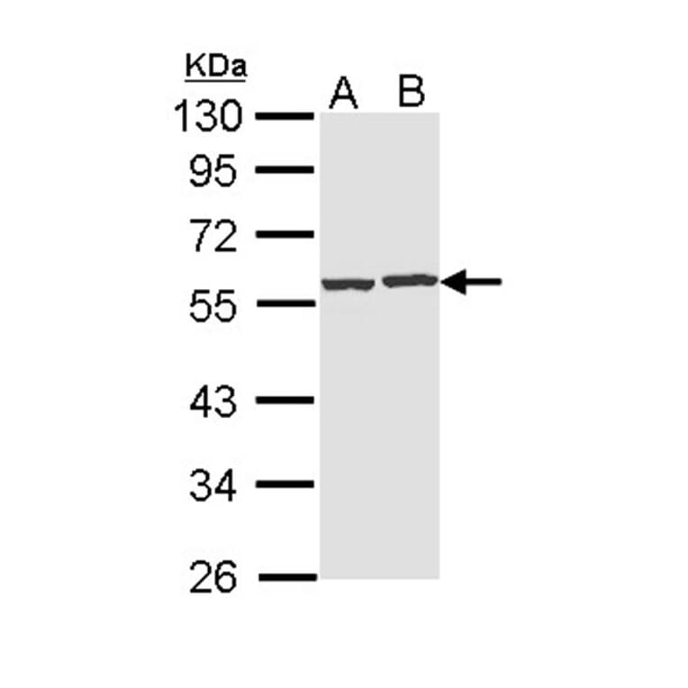 CAP1 antibody from Signalway Antibody (22330) - Antibodies.com