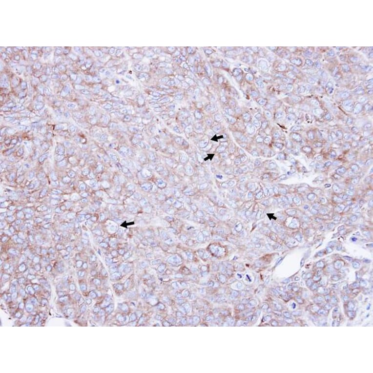 Immunohistochemistry - CAP1 antibody from Signalway Antibody (22330) - Antibodies.com