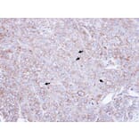 Immunohistochemistry - CAP1 antibody from Signalway Antibody (22330) - Antibodies.com