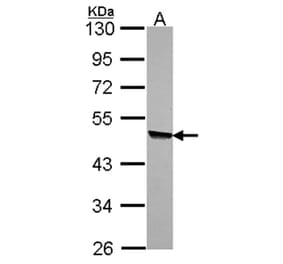 KYNU antibody from Signalway Antibody (22336) - Antibodies.com