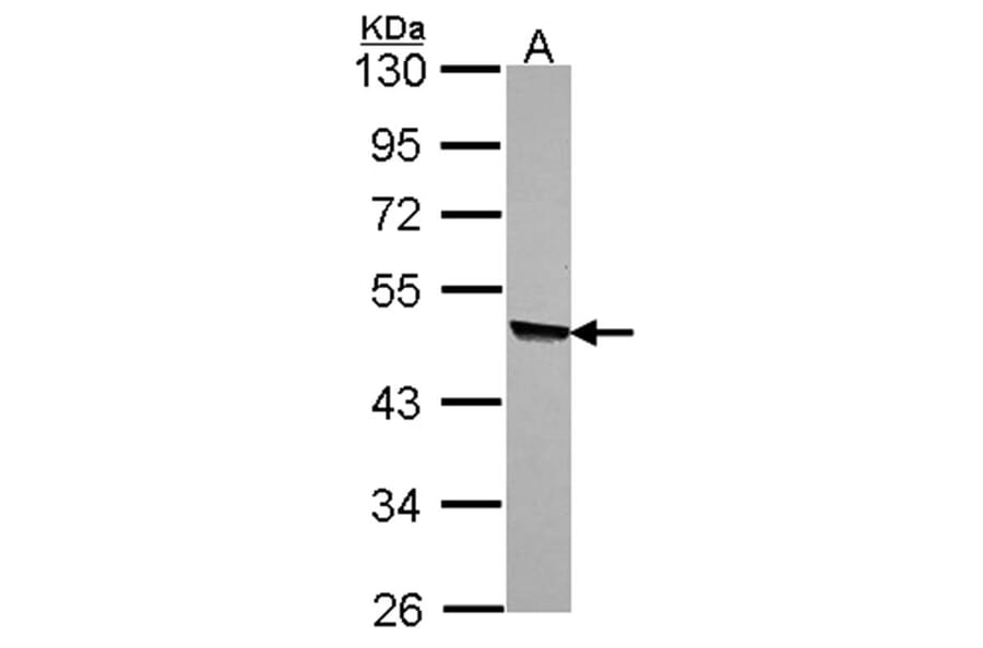 KYNU antibody from Signalway Antibody (22336) - Antibodies.com