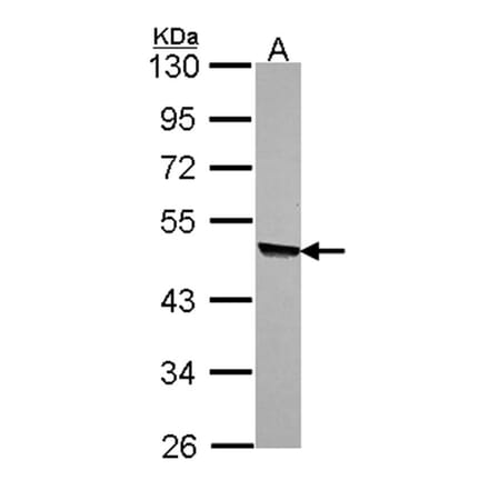 KYNU antibody from Signalway Antibody (22336) - Antibodies.com