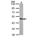KYNU antibody from Signalway Antibody (22336) - Antibodies.com