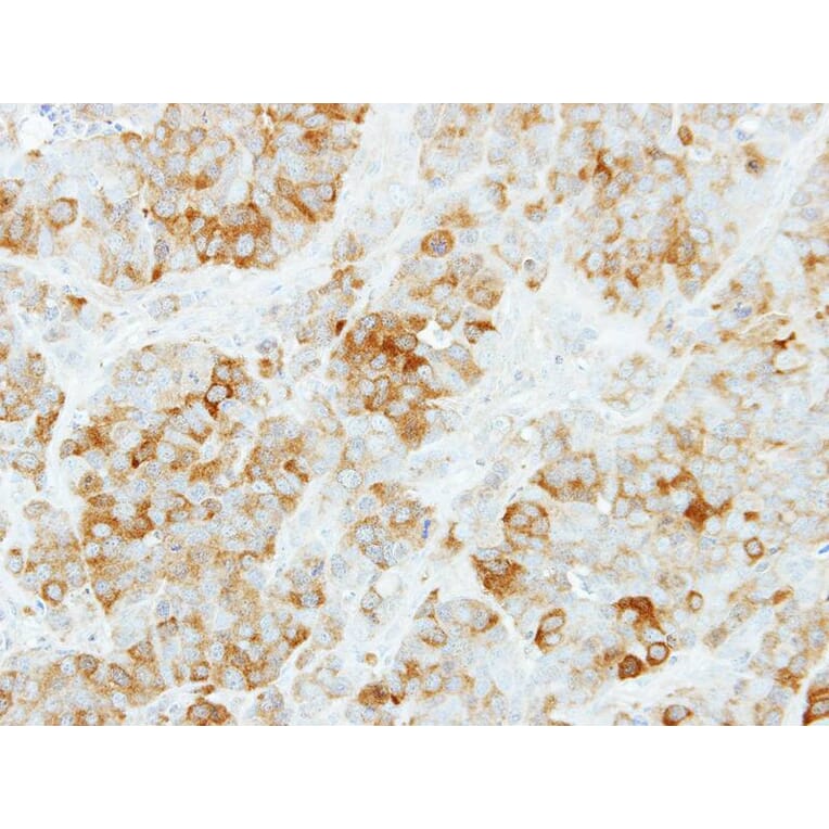 Immunohistochemistry - KYNU antibody from Signalway Antibody (22336) - Antibodies.com