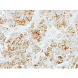 Immunohistochemistry - KYNU antibody from Signalway Antibody (22336) - Antibodies.com