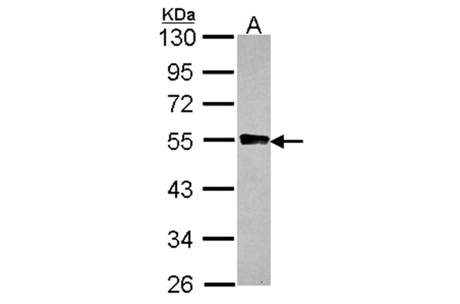 GYG2 antibody from Signalway Antibody (22338) - Antibodies.com
