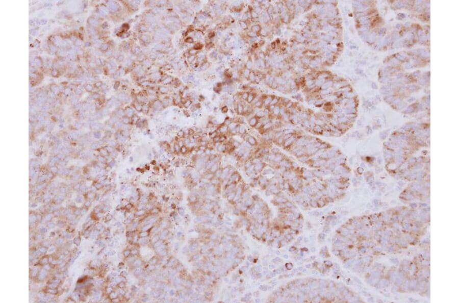 Immunohistochemistry - GYG2 antibody from Signalway Antibody (22338) - Antibodies.com
