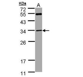 MTAP antibody from Signalway Antibody (22345) - Antibodies.com