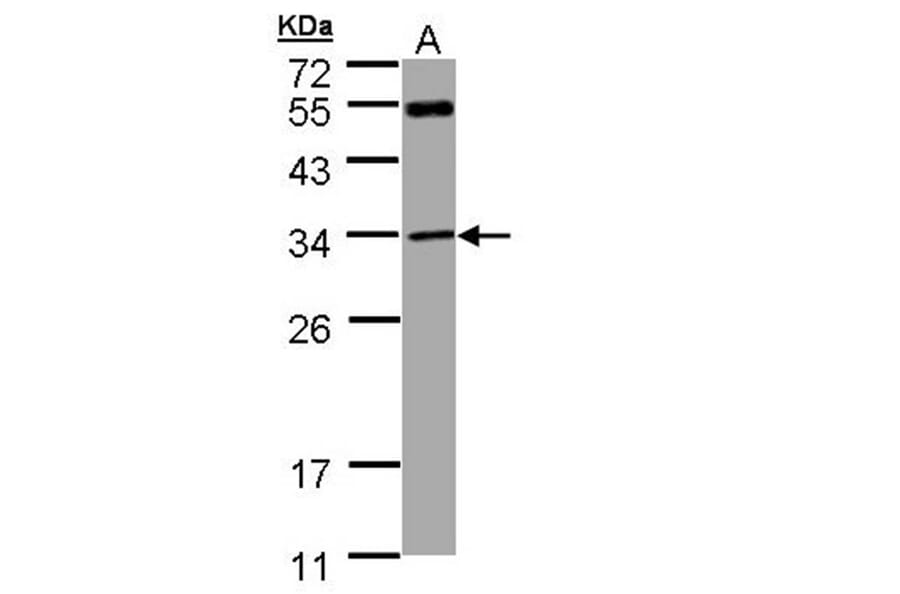 MTAP antibody from Signalway Antibody (22345) - Antibodies.com