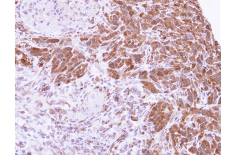 Immunohistochemistry - MTAP antibody from Signalway Antibody (22345) - Antibodies.com