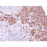 Immunohistochemistry - MTAP antibody from Signalway Antibody (22345) - Antibodies.com
