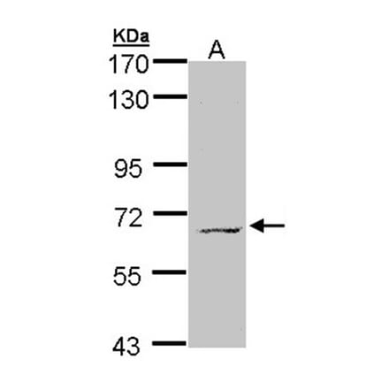 MPP3 antibody from Signalway Antibody (22349) - Antibodies.com