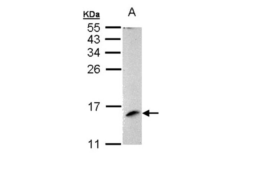 MP1 antibody from Signalway Antibody (22385) - Antibodies.com